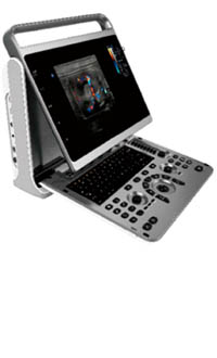 CHISON EBit30
