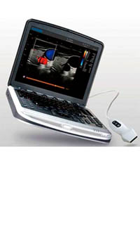 CHISON SONOBOOK8 VET