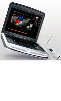 CHISON SONOBOOK8