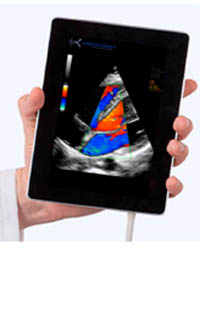 SONOSCANNER U-LITE